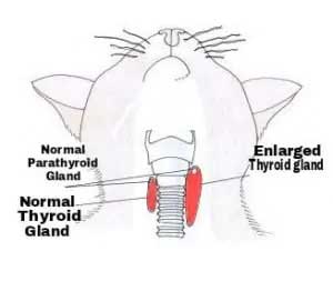 Hyperthyroidism